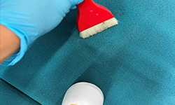 スポットシミ取り